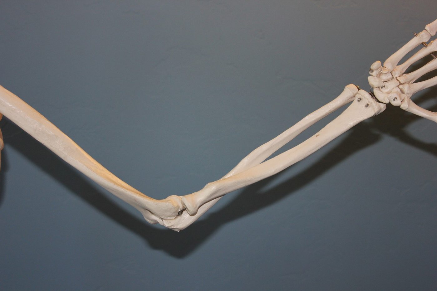 A skeletal model of an arm bent at the elbow, showing the bones and joint involved in many everyday injuries.